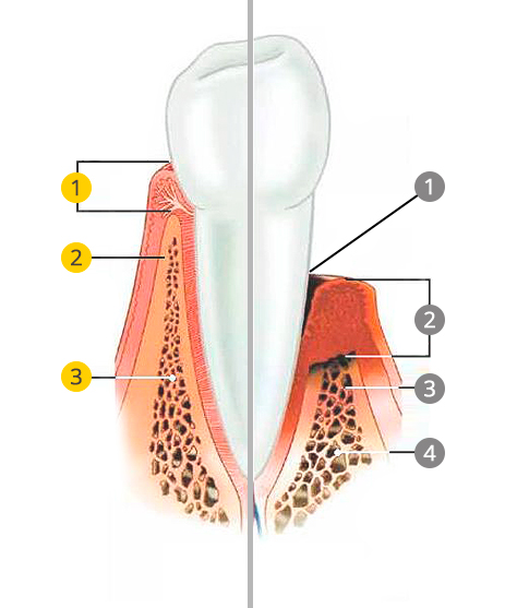 Mantenimientos periodontales San Sebastián